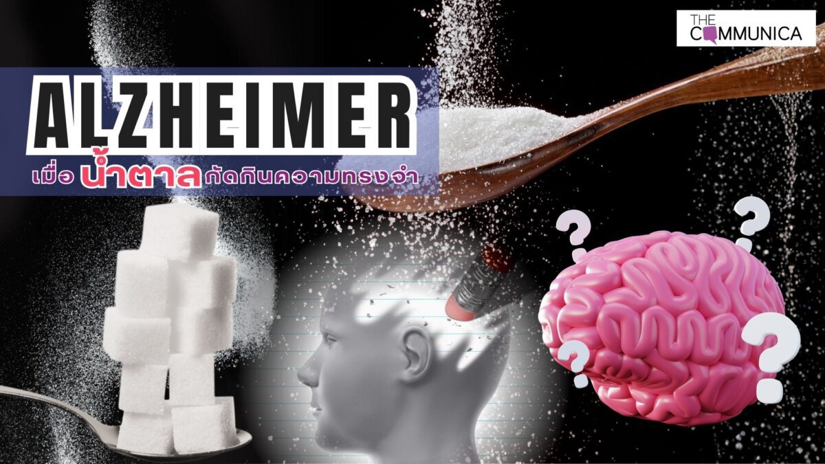 อัลไซเมอร์... เบาหวานชนิดที่ 3