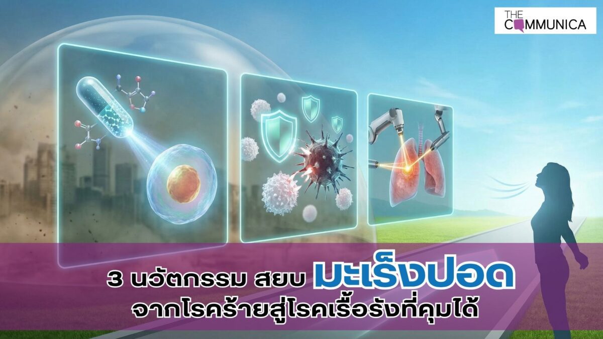 3 นวัตกรรมสยบมะเร็งปอดจากโรคร้ายสู่โรคเรื้อรังที่คุมได้