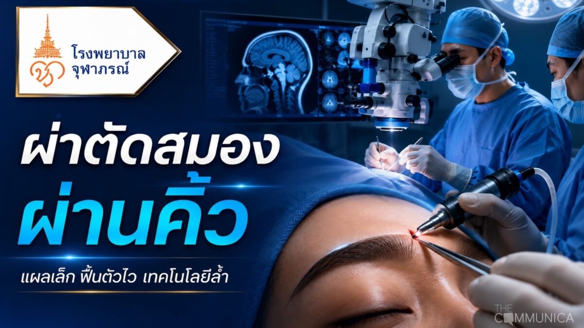ผ่าตัดสมองผ่านคิ้ว แผลเล็ก ฟื้นตัวไว เทคโนโลยีล้ำจากโรงพยาบาลจุฬาภรณ์